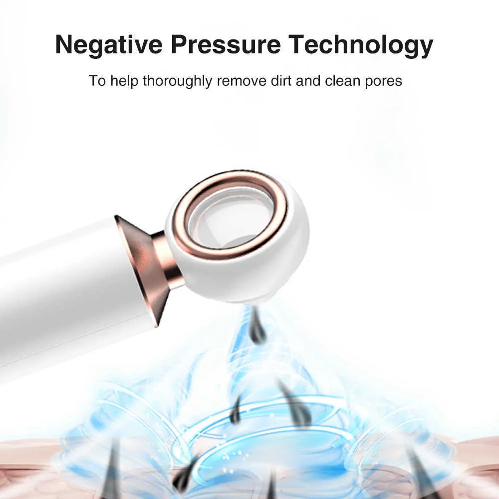 SANQUIX™ Blackhead Suction Machine