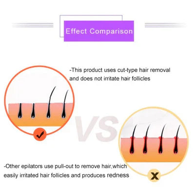 SANQUIX™Purple Epilator – آلة إزالة الشعر البنفسجية