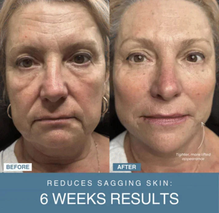 SANQUIX™ 7-in-1 LED Anti-Aging/Wrinkle Apparatus