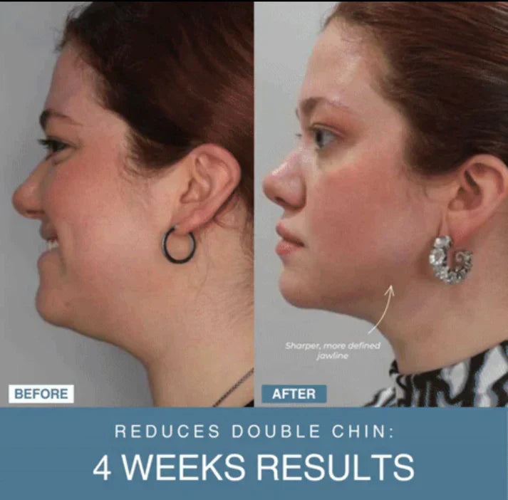 SANQUIX™ 7-in-1 LED Anti-Aging/Wrinkle Apparatus