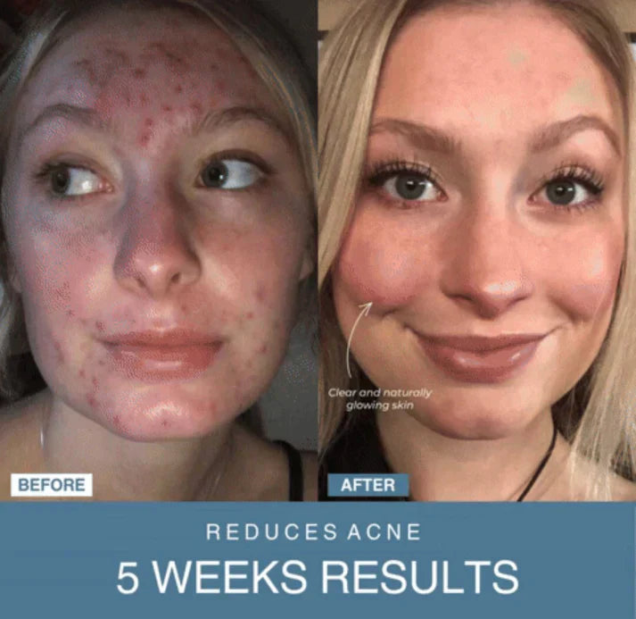 SANQUIX™ 7-in-1 LED Anti-Aging/Wrinkle Apparatus