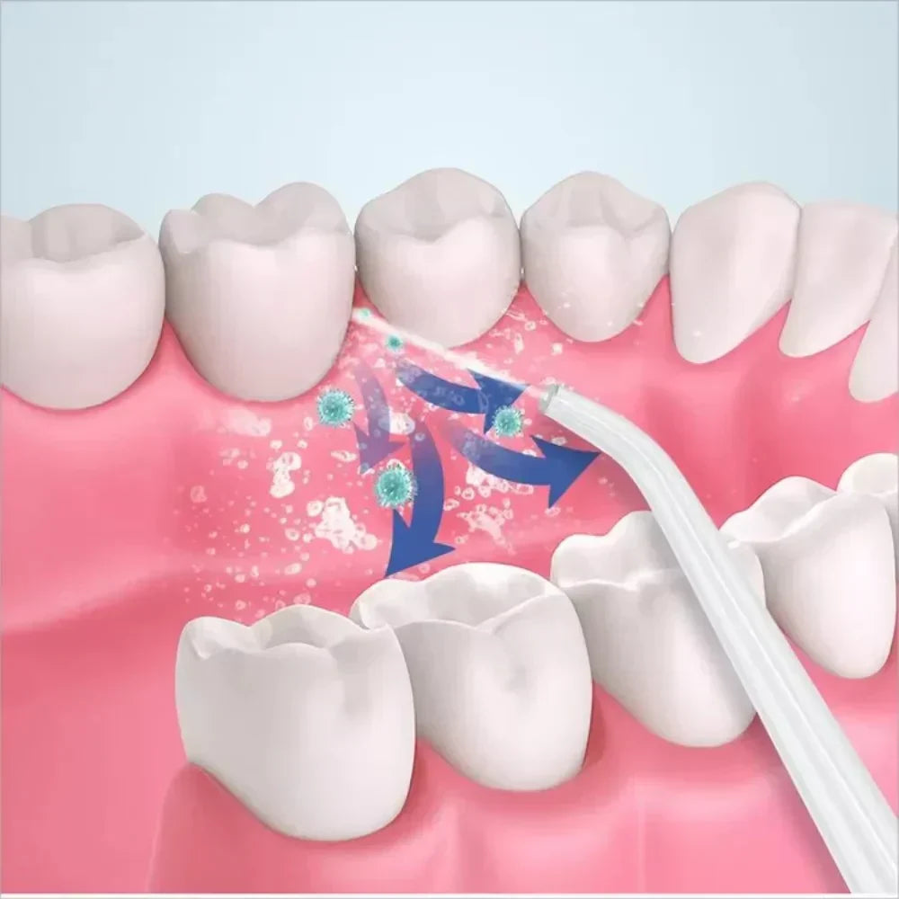 SANQUIX™3 In 1 Oral Irrigatorجهاز ري الفم 3 في 1