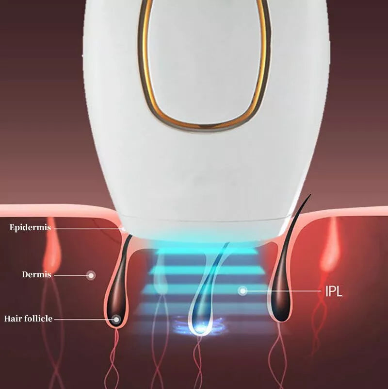 SANQUIX™ IPL Laser Hair Removal – جهاز إزالة الشعر بالليزر IPL